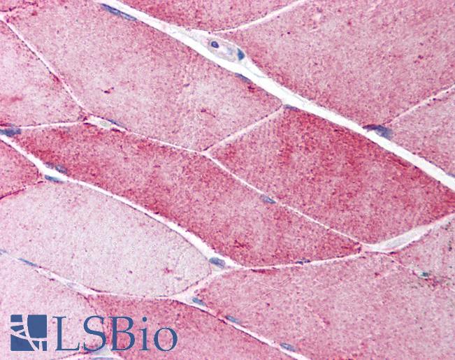 Anti-CAV3 / Caveolin 3 antibody IHC of human skeletal muscle. Immunohistochemistry of formalin-fixed, paraffin-embedded tissue after heat-induced antigen retrieval. Antibody LS-B1513 concentration 5 ug/ml.