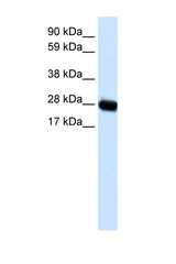 CAV3 / Caveolin 3 antibody LS-B1513 Western blot of Fetal muscle lysate. Antibody concentration 1 ug/ml.