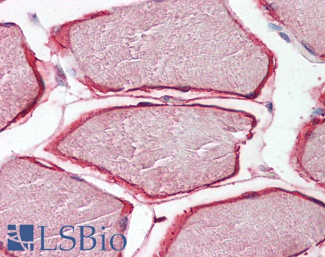 Anti-Caveolin 3 antibody IHC of human skeletal muscle. Immunohistochemistry of formalin-fixed, paraffin-embedded tissue after heat-induced antigen retrieval. Antibody LS-B8308 dilution 3.75 ug/ml.