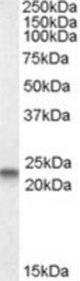 CAV3 antibody (0.3 ug/ml) staining of Human Heart lysate (35 ug protein/ml in RIPA buffer). Primary incubation was 1 hour. Detected by chemiluminescence.