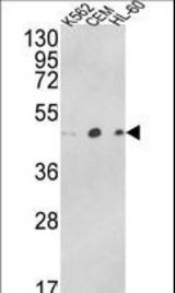 Western blot of ACTR3B Antibody in K562, CEM, HL-60 cell line lysates (35 ug/lane). ACTR3B (arrow) was detected using the purified antibody.