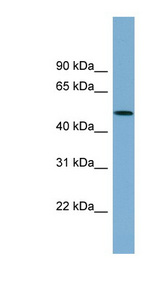 ACTR3B antibody LS-C112060 Western blot of 721_B cell lysate.