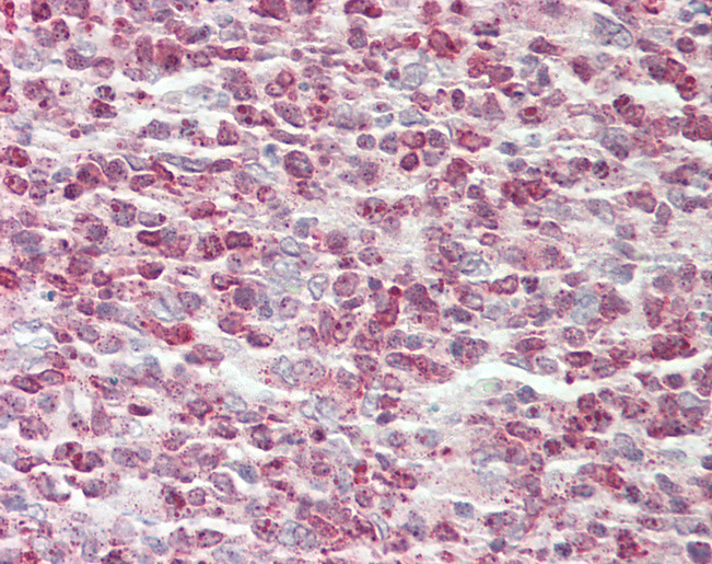 Human Tonsil: Formalin-Fixed, Paraffin-Embedded (FFPE)