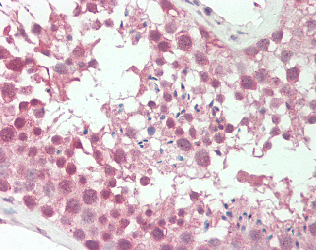 Human Testis: Formalin-Fixed, Paraffin-Embedded (FFPE)