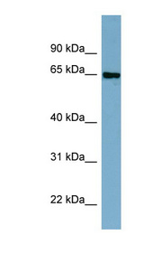 CBFA2T2 antibody LS-C107830 Western blot of Fetal Thymus lysate.