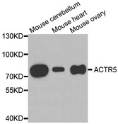 Western blot analysis of extracts of various cell lines, using ACTR5 antibody.