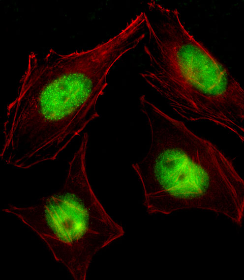 Fluorescent image of HeLa cell stained with CBFA2T2 Antibody. HeLa cells were fixed with 4% PFA (20 min), permeabilized with Triton X-100 (0.1%, 10 min), then incubated with CBFA2T2 primary antibody (1:25, 1 h at 37°C). For secondary antibody, Alexa Fluor 488 conjugated donkey anti-rabbit antibody (green) was used (1:400, 50 min at 37°C). Cytoplasmic actin was counterstained with Alexa Fluor 555 (red) conjugated Phalloidin (7units/ml, 1 h at 37°C). CBFA2T2 immunoreactivity is localized to Nucleus significantly.