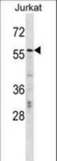 CBFA2T2 Antibody western blot of Jurkat cell line lysates (35 ug/lane). The CBFA2T2 antibody detected the CBFA2T2 protein (arrow).