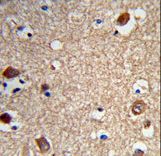 Formalin-fixed and paraffin-embedded human brain tissue reacted with ACTR5 Antibody , which was peroxidase-conjugated to the secondary antibody, followed by DAB staining. This data demonstrates the use of this antibody for immunohistochemistry; clinical relevance has not been evaluated.