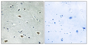 IHC of paraffin-embedded human brain tissue, using MTG16 Antibody. The picture on the right is treated with the synthesized peptide.