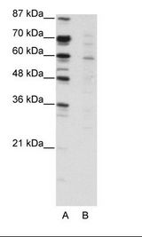 A: Marker, B: Jurkat Cell Lysate