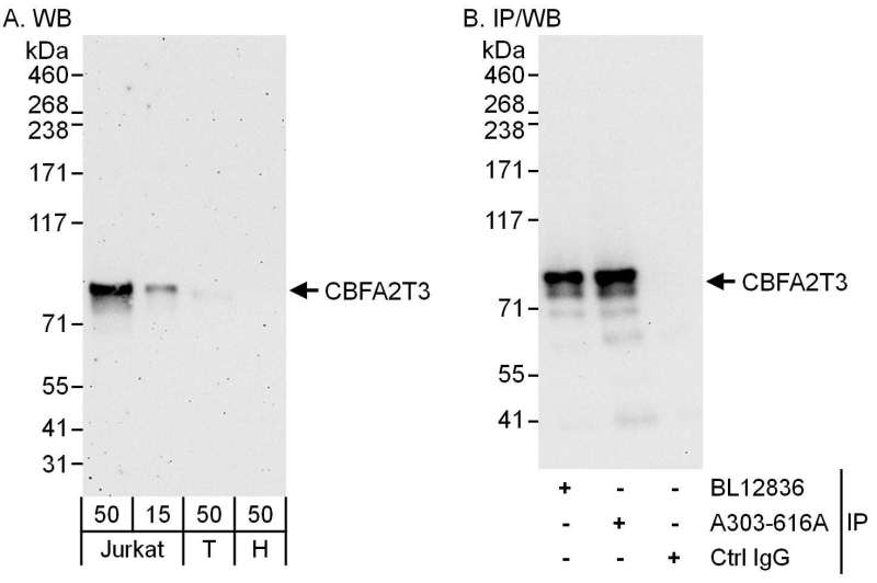 Detection of Human CBFA2T3 by Western Blot and Immunoprecipitation. Samples: Whole cell lysate from Jurkat (15 and 50 ug for WB; 1 mg for IP, 20% of IP loaded), 293T (T; 50 ug) and HeLa (H; 50 ug) cells. Antibodies: Affinity purified rabbit anti-CBFA2T3 antibody used for WB at 0.1 ug/ml (A) and 1 ug/ml (B) and used for IP at 6 ug/mg lysate. CBFA2T3 was also immunoprecipitated by rabbit anti-CBFA2T3 antibody BL12836, which recognizes an upstream epitope. Detection: Chemiluminescence with exposure times of 3 minutes (A) and 10 seconds (B).