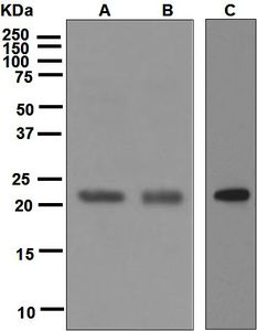 Western blot analysis on (A) K562, (B) Jurkat, and (C) HUVEC cell lysates using anti-CBFb antibody.