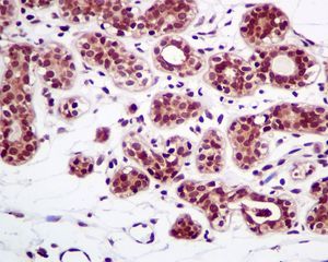 IHC of paraffin-embedded human breast tissue using anti-CBFb antibody.