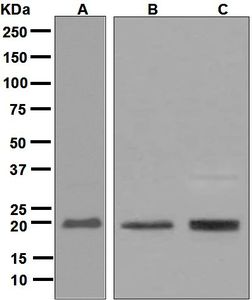Western blot analysis on (A) K562, (B) HUVEC, and (C) Jurkat cell lysates using anti-CBFb antibody.