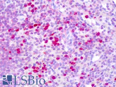 Anti-CBFB antibody IHC of human spleen. Immunohistochemistry of formalin-fixed, paraffin-embedded tissue after heat-induced antigen retrieval. Antibody LS-B8269 dilution 5-10 ug/ml.