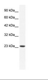 K562 Cell Lysate