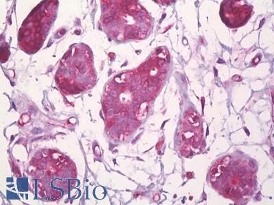 Anti-CBFB antibody IHC of human breast, epithelium. Immunohistochemistry of formalin-fixed, paraffin-embedded tissue after heat-induced antigen retrieval. Antibody LS-B7059 concentration 10 ug/ml.