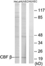Western blot of extracts from HUVEC/HeLa cells, using CBF beta Antibody. The lane on the right is treated with the synthesized peptide.