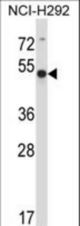 ACTR6 Antibody western blot of NCI-H292 cell line lysates (35 ug/lane). The ACTR6 antibody detected the ACTR6 protein (arrow).