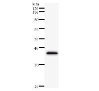 Western blot analysis of immunized recombinant protein, using anti-CBLB monoclonal antibody.
