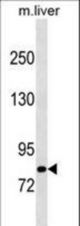 Mouse Cblb Antibody western blot of mouse liver tissue lysates (35 ug/lane). The Cblb antibody detected the Cblb protein (arrow).
