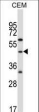 CBLC Antibody (R10) western blot of CEM cell line lysates (35 ug/lane). The CBLC antibody detected the CBLC protein (arrow).