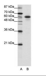 A: Marker, B: HepG2 Cell Lysate