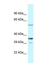 CBLL1 antibody LS-C145756 Western blot of Mouse Kidney lysate. Antibody concentration 1 ug/ml.