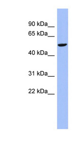 CBLL1 antibody LS-C110416 Western blot of COLO205 cell lysate.