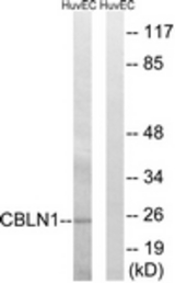 Western blot of extracts from HUVEC cells, using CBLN1 Antibody. The lane on the right is treated with the synthesized peptide.