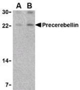 Western blot of precerebellin in mouse cerebellum lysate with LS-B478 at (A) 2 and (B) 4 ug/ml.