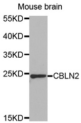 Western blot analysis of extracts of Mouse brain cell line, using CBLN2 antibody.