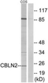 Western blot of extracts from COS cells, using CBLN2 Antibody. The lane on the right is treated with the synthesized peptide.