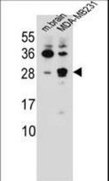 CBLN2 Antibody western blot of mouse brain tissue and MDA-MB231 cell line lysates (35 ug/lane). The CBLN2 antibody detected the CBLN2 protein (arrow).