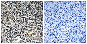 IHC of paraffin-embedded human thymus gland tissue, using CBLN4 Antibody. The picture on the right is treated with the synthesized peptide.