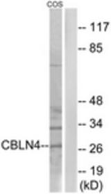 Western blot of extracts from COS cells, using CBLN4 Antibody. The lane on the right is treated with the synthesized peptide.