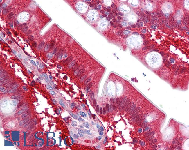 Anti-CBR1 antibody IHC of human small intestine. Immunohistochemistry of formalin-fixed, paraffin-embedded tissue after heat-induced antigen retrieval. Antibody LS-B6268 concentration 10 ug/ml.