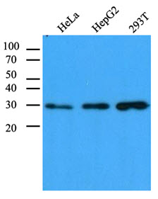 Cell lysates (40 ug) were resolved by SDS-PAGE, transferred to PVDF membrane and probed with anti-human CBR1 antibody (1:1000). Proteins were visualized using a goat anti-mouse secondary antibody conjugated to HRP and an ECL detection system.