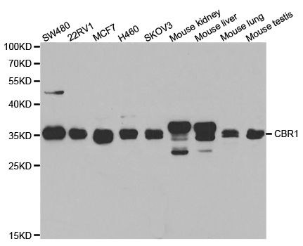 Western blot analysis of extracts of various cell lines, using CBR1 antibody.