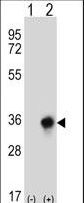 Western blot of CBR3 (arrow) using rabbit polyclonal CBR3 Antibody. 293 cell lysates (2 ug/lane) either nontransfected (Lane 1) or transiently transfected (Lane 2) with the CBR3 gene.