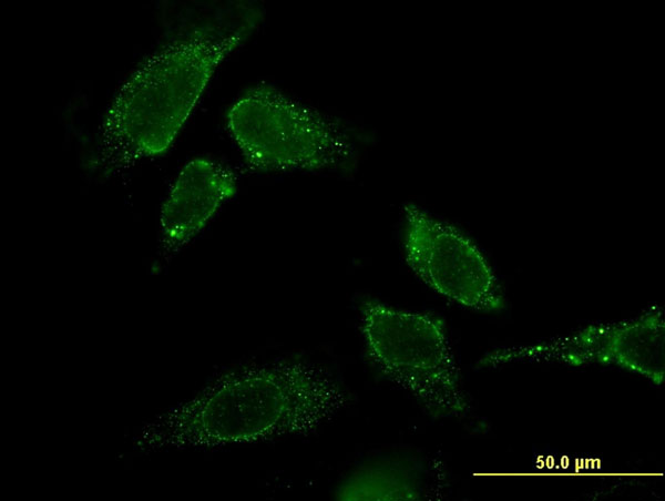Immunofluorescence of monoclonal antibody to CBR3 on HeLa cell . [antibody concentration 10 ug/ml]