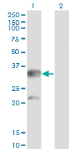Western Blot analysis of CBR3 expression in transfected 293T cell line by CBR3 monoclonal antibody (M05), clone 1G8.Lane 1: CBR3 transfected lysate (Predicted MW: 30.9 KDa).Lane 2: Non-transfected lysate.