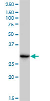 CBR3 monoclonal antibody (M05), clone 1G8. Western Blot analysis of CBR3 expression in HepG2.