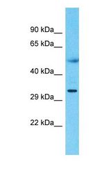 Western blot of CBR3 Antibody with Colorectal Tumor lysate.