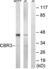 Western blot of extracts from Jurkat/MCF7 cells, using CBR3 Antibody. The lane on the right is treated with the synthesized peptide.