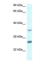 CBR4 antibody LS-C145459 Western blot of Jurkat Cell lysate. Antibody concentration 1 ug/ml.