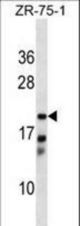 CBR4 Antibody western blot of ZR-75-1 cell line lysates (35 ug/lane). The CBR4 antibody detected the CBR4 protein (arrow).