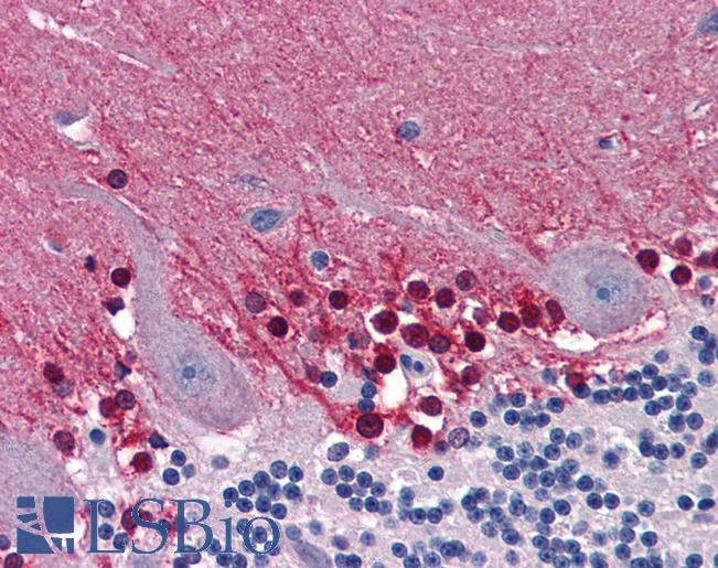 Anti-CBS antibody IHC of human brain, cerebellum. Immunohistochemistry of formalin-fixed, paraffin-embedded tissue after heat-induced antigen retrieval. Antibody LS-B6016 concentration 5 ug/ml.