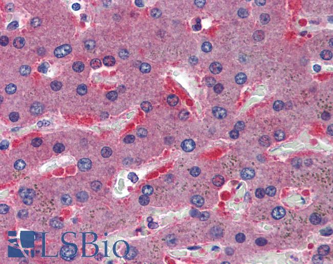 Anti-CBS antibody IHC of human liver. Immunohistochemistry of formalin-fixed, paraffin-embedded tissue after heat-induced antigen retrieval. Antibody LS-B6016 concentration 5 ug/ml.